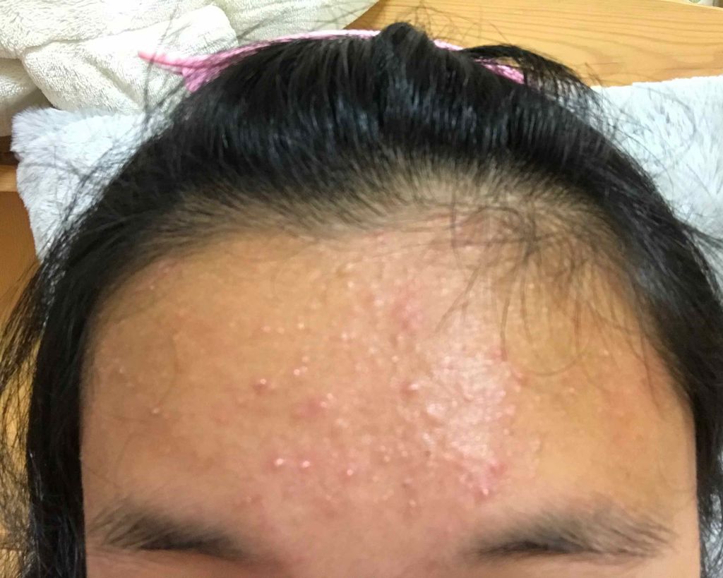 ハトムギ化粧水(ナチュリエ スキンコンディショナー R )/ナチュリエ/化粧水を使ったクチコミ（1枚目）