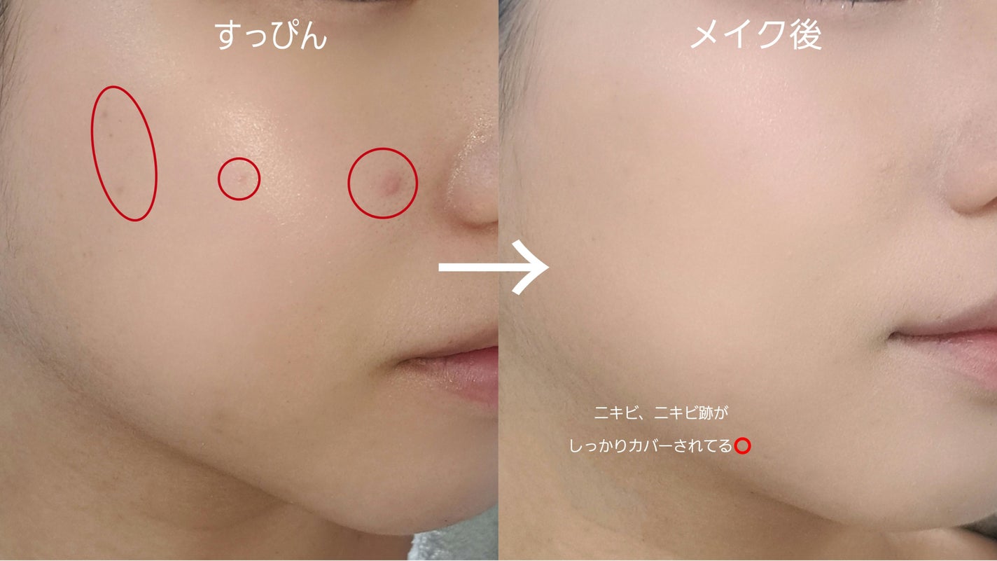 薬用コンシーラー アクネプロテクター/ONLY MINERALS/パウダーコンシーラーを使ったクチコミ(3枚目)