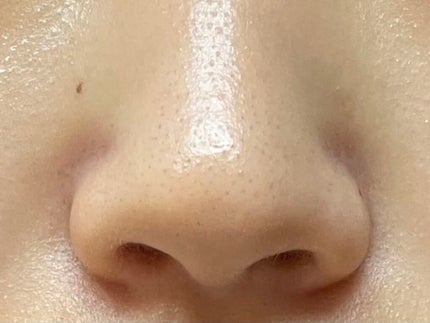 ハトムギ化粧水(ナチュリエ スキンコンディショナー R )/ナチュリエ/化粧水を使ったクチコミ(3枚目)