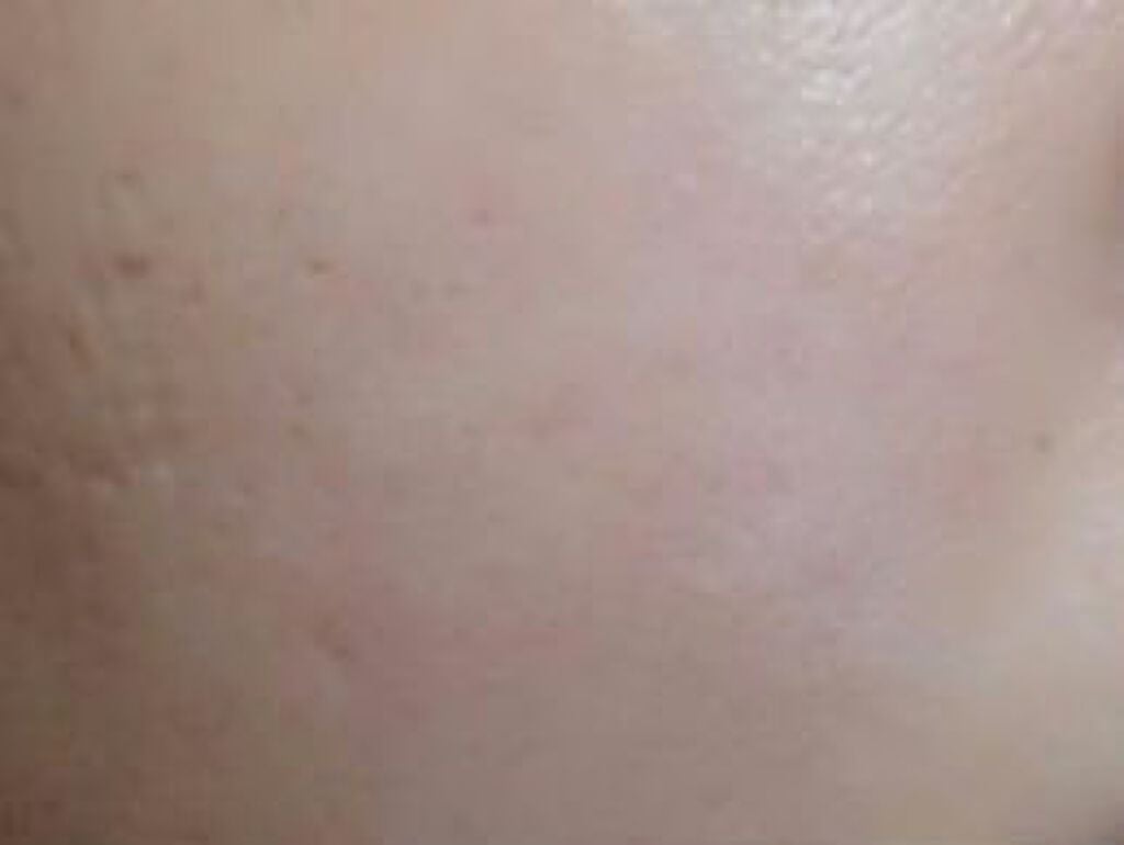 美白化粧水 VC/ちふれ/化粧水を使ったクチコミ(2枚目)