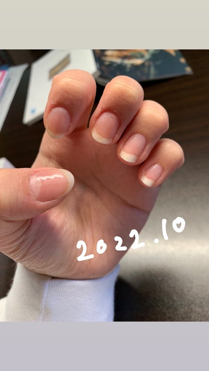 エテュセ クイックケアコート/ettusais/ネイルオイル・トリートメントを使ったクチコミ(8枚目)