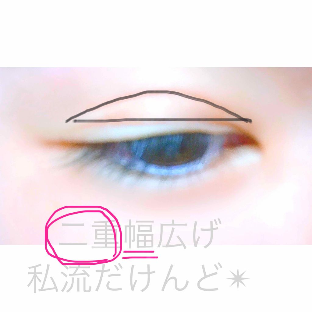 絆創膏/その他を使ったクチコミ（1枚目）