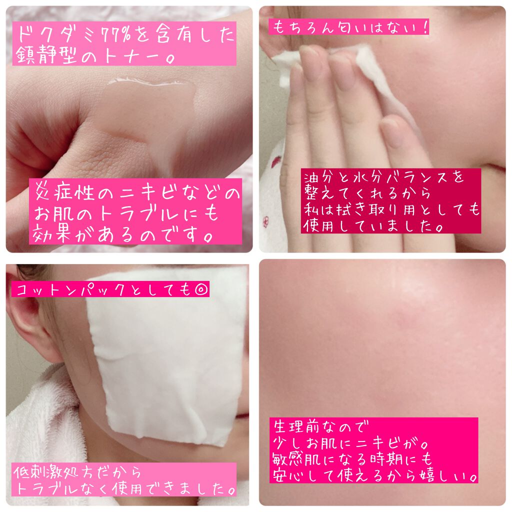 ドクダミ 77 スージングトナー/Anua/化粧水を使ったクチコミ(1枚目)