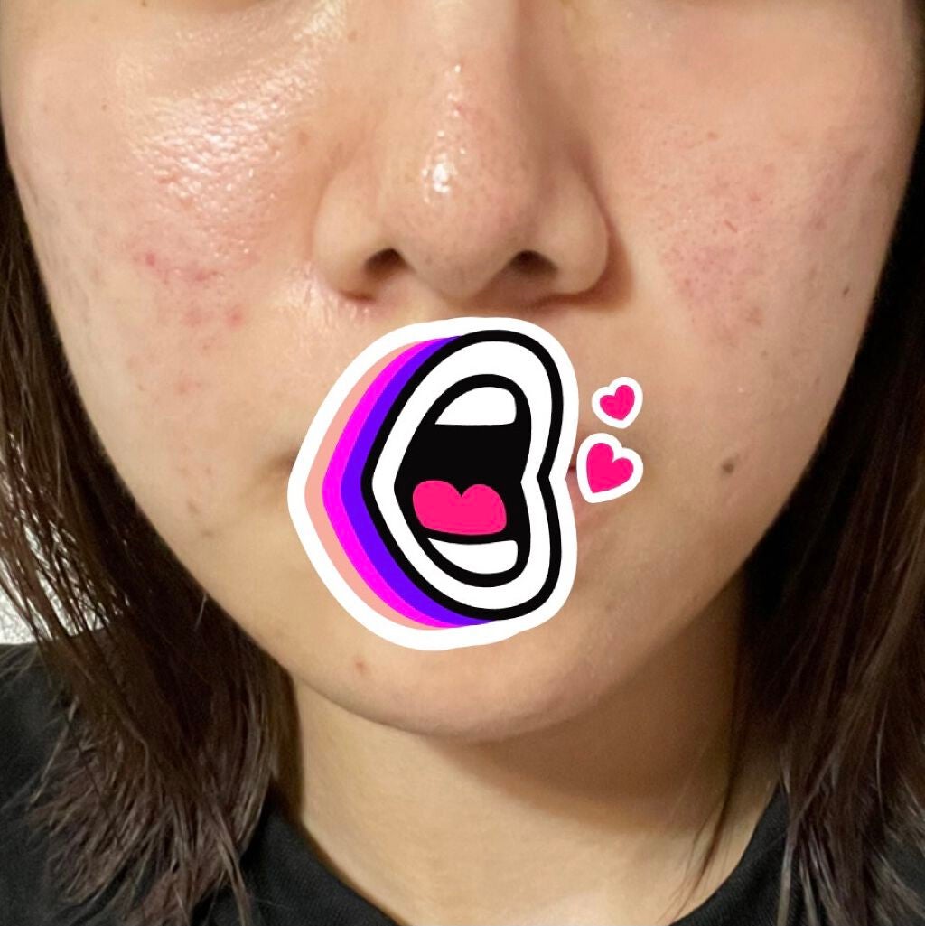 たべっこ on LIPS 「8/24(火)☁️夜やっぱビタミンCのパックいいんかも!気持ち..」(1枚目)