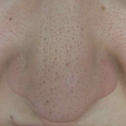 毛穴レスコンシーラー/CEZANNE/クリームコンシーラーを使ったクチコミ(3枚目)