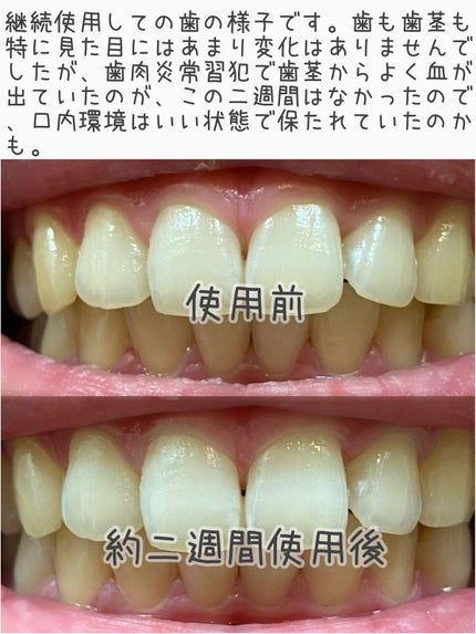 ピュオーラ36500 薬用ハグキ高密着クリームハミガキ/ピュオーラ/歯磨き粉を使ったクチコミ(5枚目)