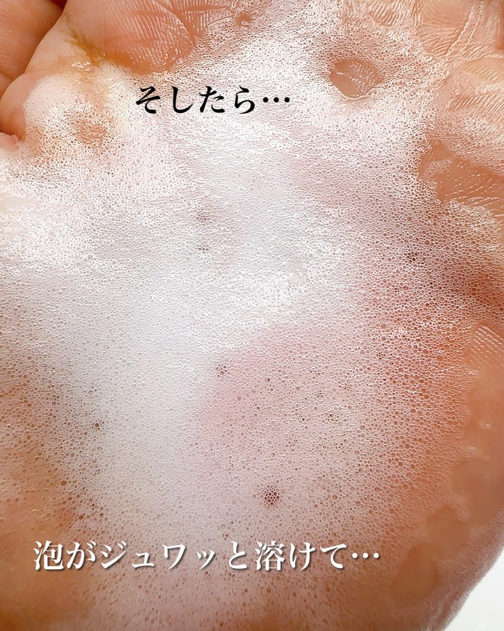 まるみ♡ on LIPS 「ドクターメラクチンから発売になったばかりの🫧メルティングクレン..」(8枚目)