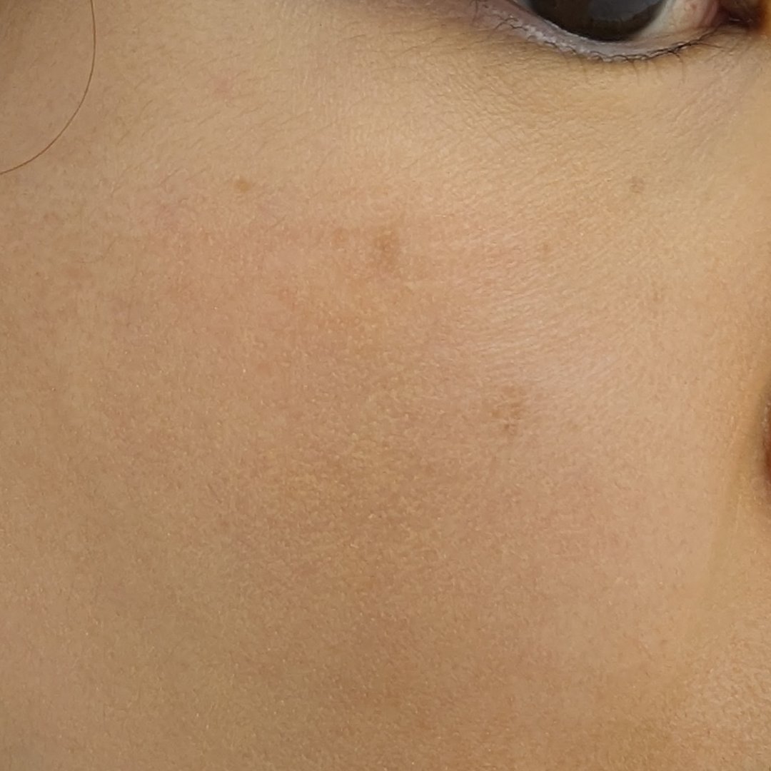 アディクション ザ ファンデーション リフトグロウ 007：ライト ベージュ/ADDICTION/リキッドファンデーションを使ったクチコミ（3枚目）