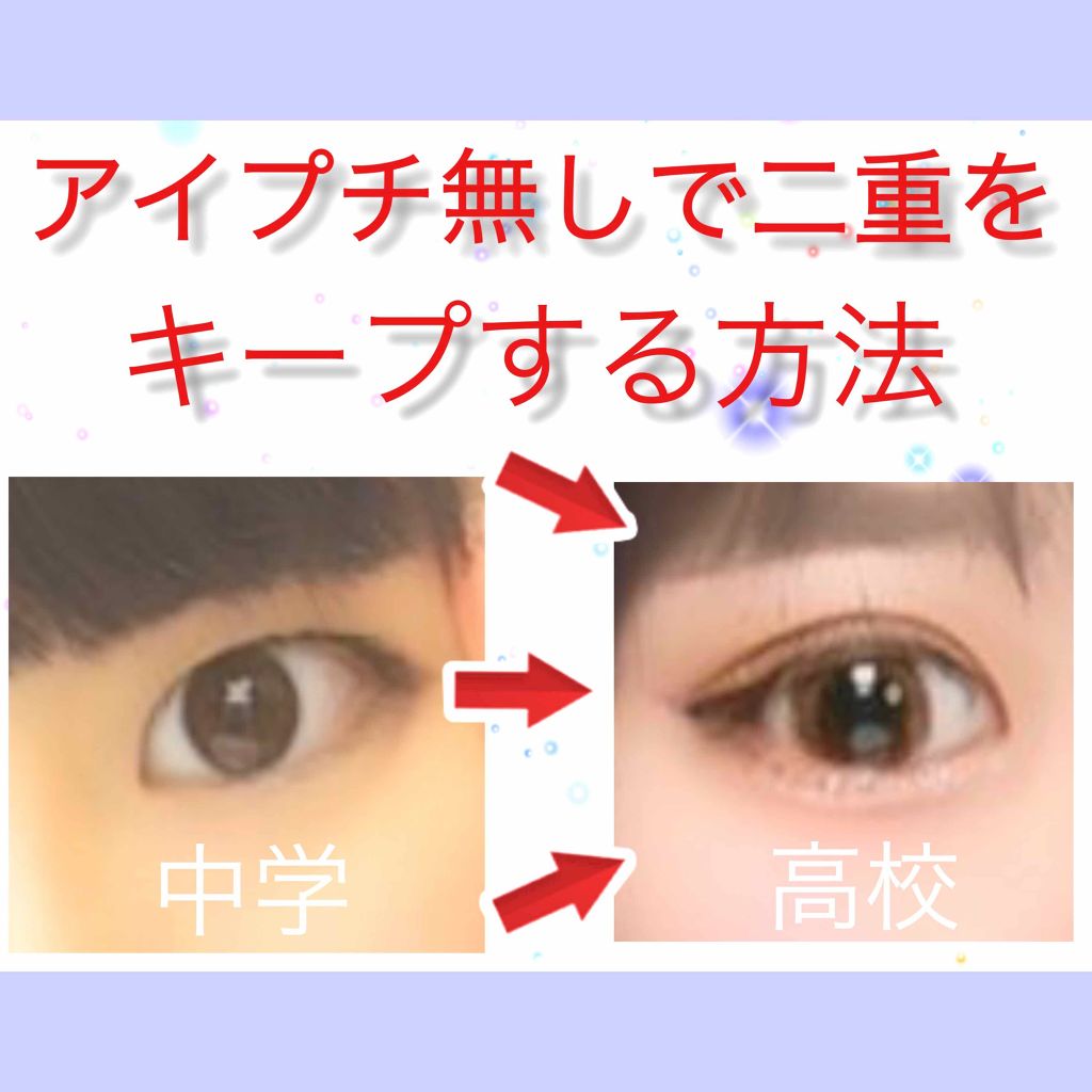 アイテープ(絆創膏タイプ、レギュラー、70枚)/DAISO/二重まぶた用アイテムを使ったクチコミ(1枚目)