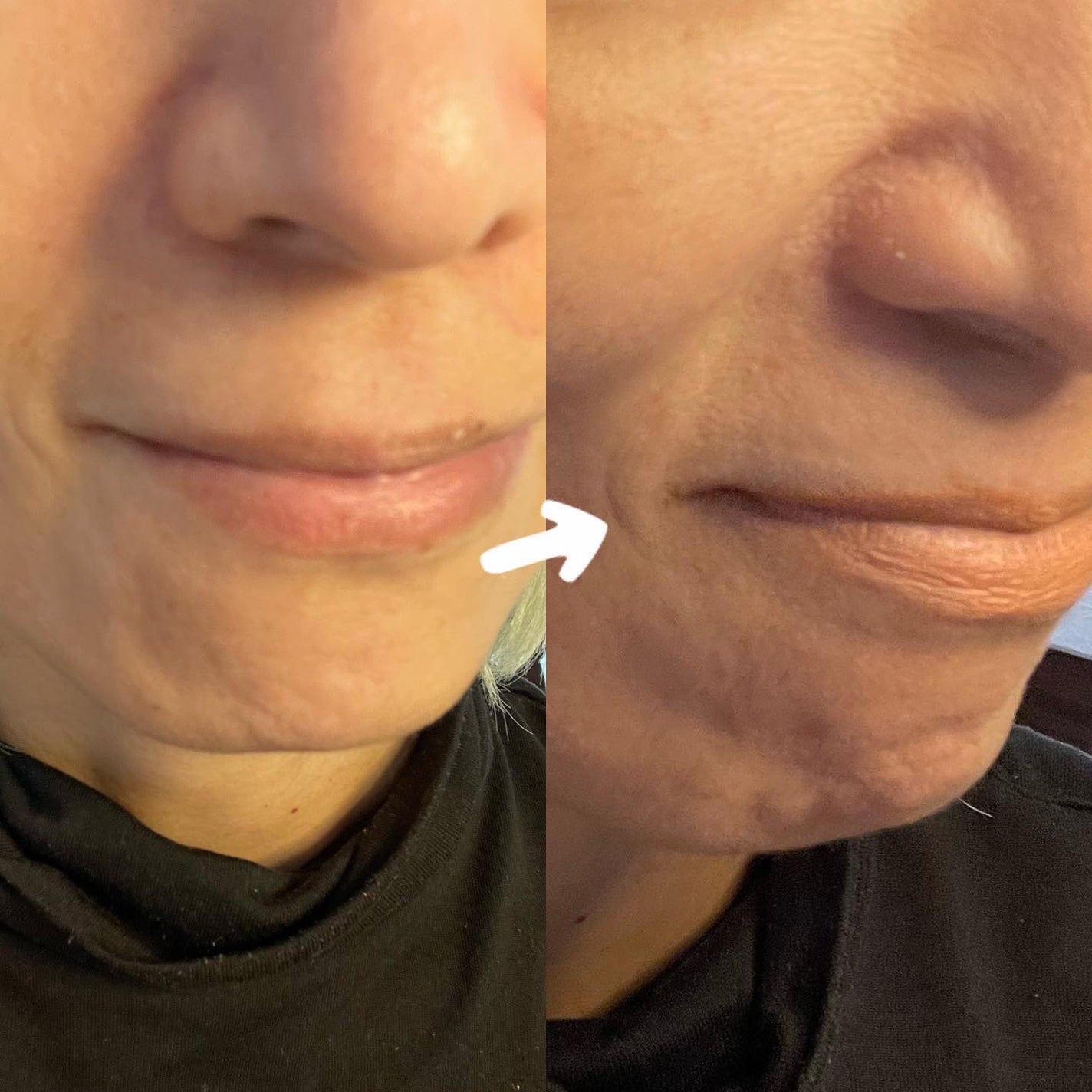 リップ&チーク/WHOMEE/ジェル・クリームチークを使ったクチコミ(5枚目)