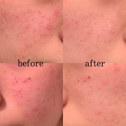 ガムシートマスクパック マデカソサイドステッカー/Abib /シートマスク・パックを使ったクチコミ(3枚目)