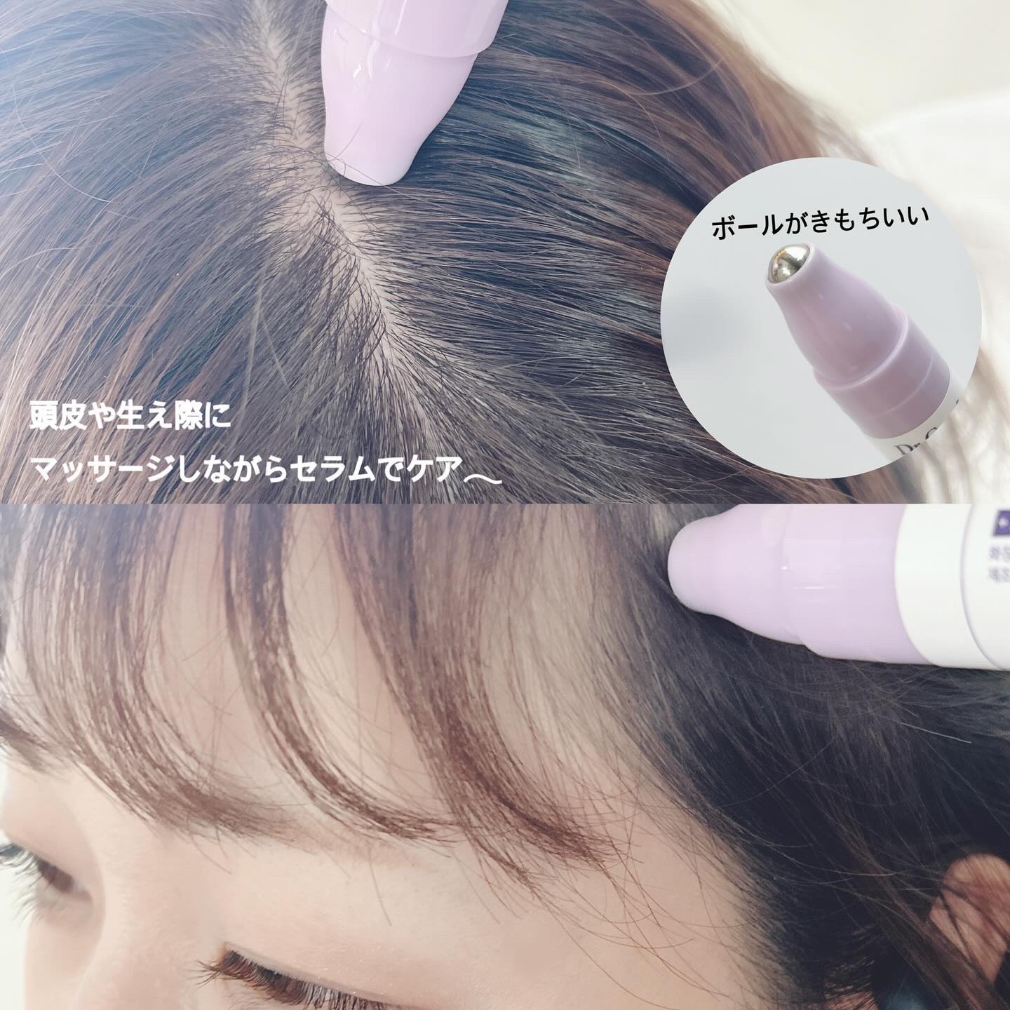 アクア頭皮 ロールオン/Dr.Groot/頭皮ローションを使ったクチコミ（3枚目）