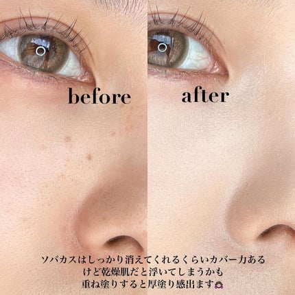 ウルトラスリムクッション+レフィルセット/APRILSKIN/クッションファンデーションを使ったクチコミ(5枚目)