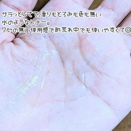 ドクダミ 77 スージングトナー/Anua/化粧水を使ったクチコミ(2枚目)