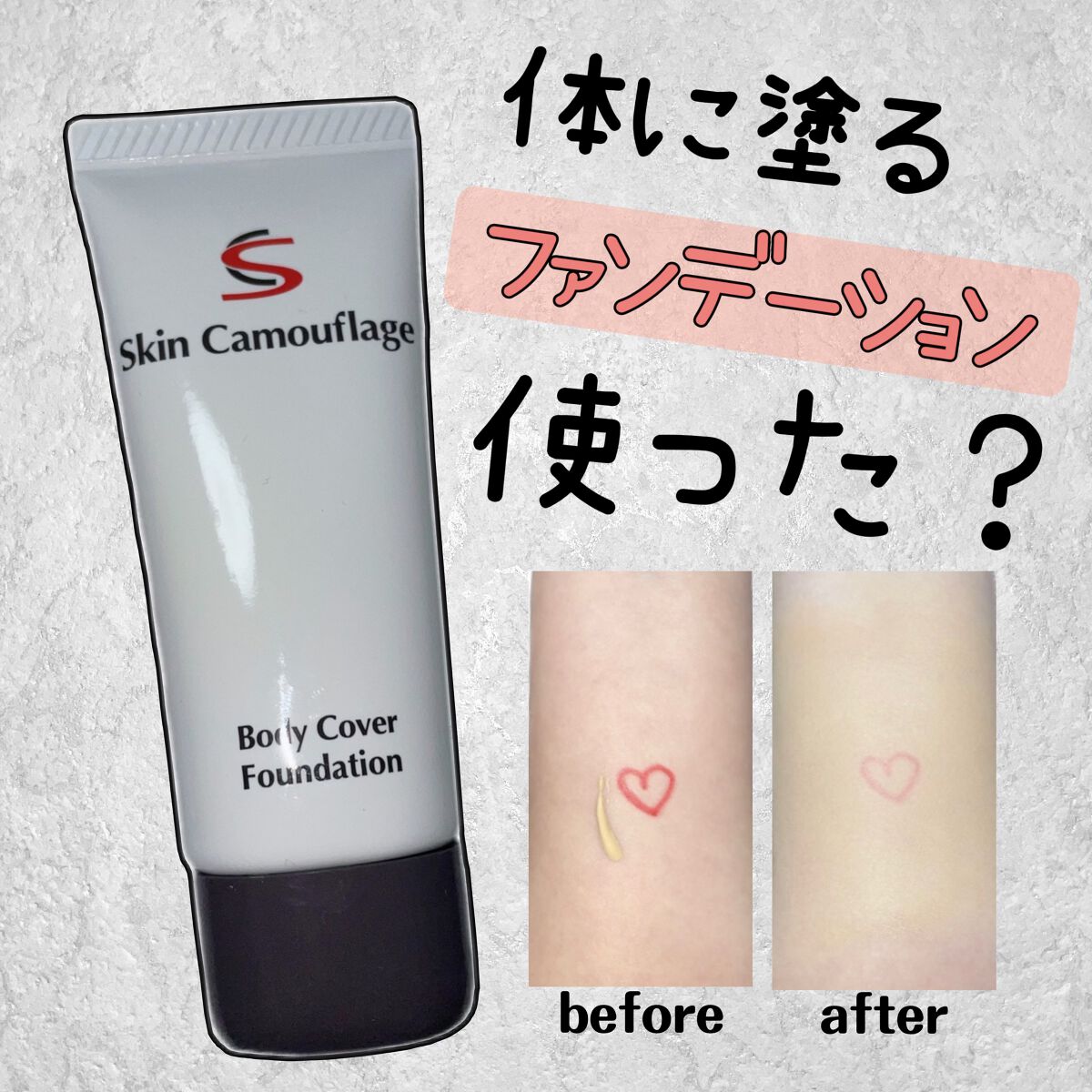 マーシュフィールド SC ボディカバーファンデN/マーシュ・フィールド/クリーム・エマルジョンファンデーションを使ったクチコミ（1枚目）