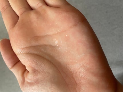 バイオヒールボ プロバイオダーム 3Dリフティングクリーム/BIOHEAL BOH/フェイスクリームを使ったクチコミ(5枚目)