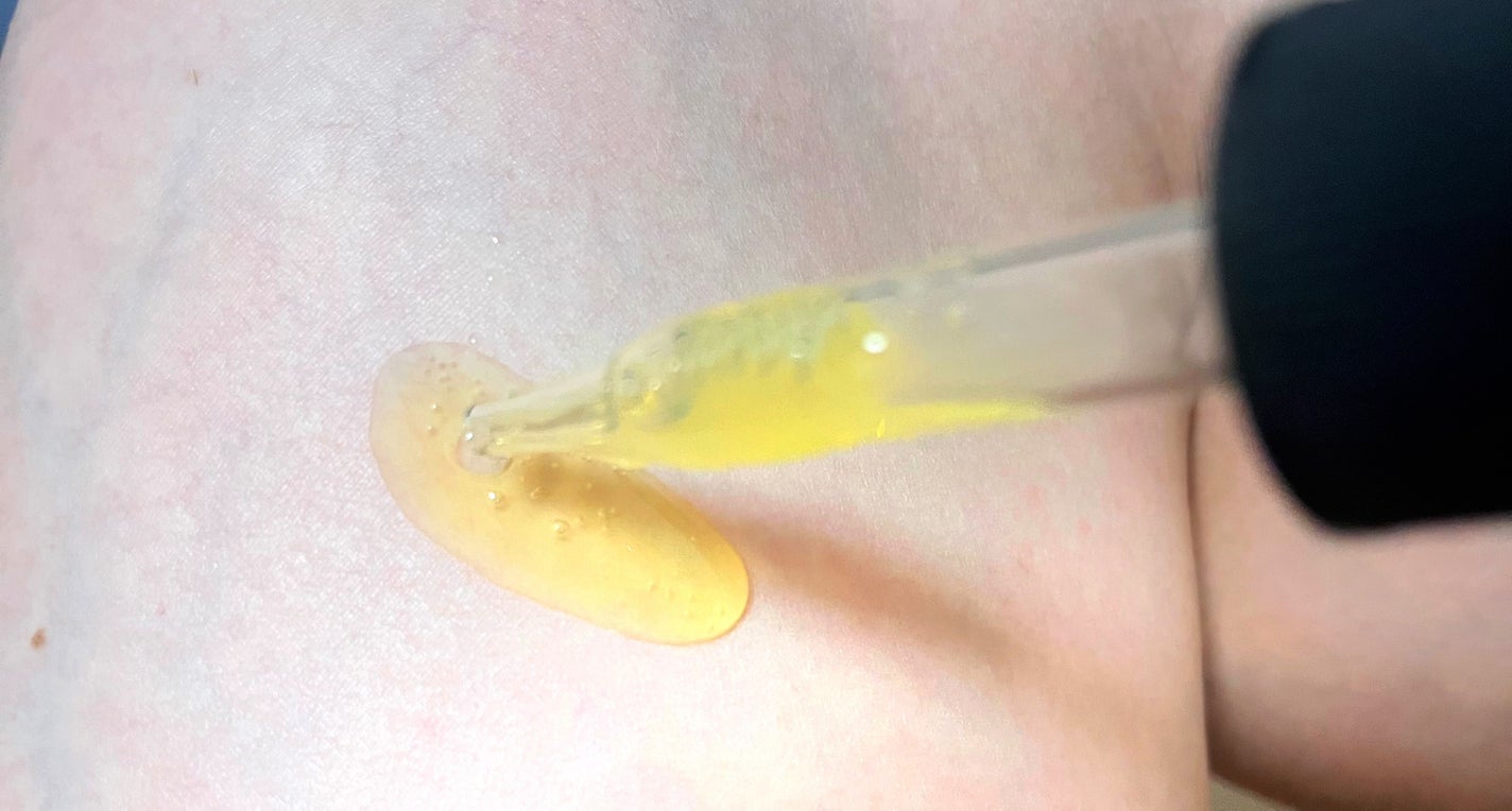 スーパーリンクルセラムVA/KISO/美容液を使ったクチコミ(2枚目)