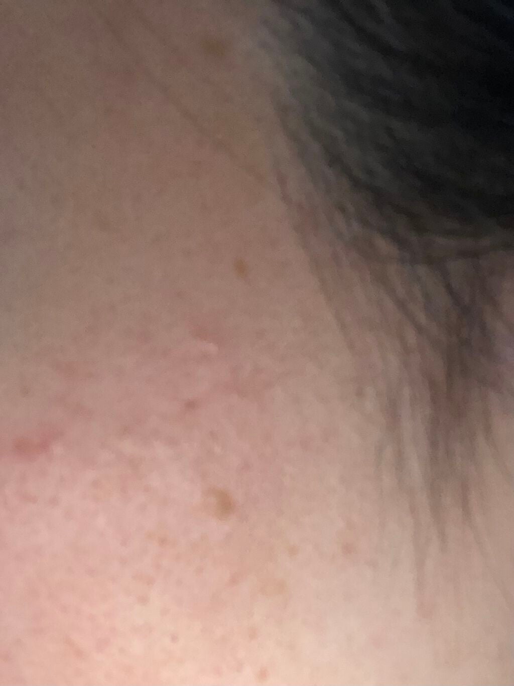 メラノショット ホワイト D/ONE BY KOSE/美容液を使ったクチコミ(3枚目)