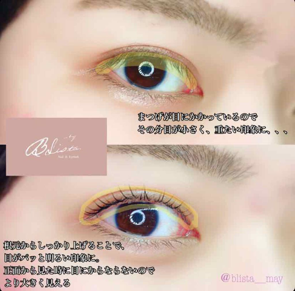 ビューティラッシュN/まつげ美容液を使ったクチコミ（2枚目）
