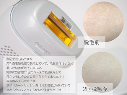 光エステ スムースエピ ES-WG0A/Panasonic/家庭用脱毛器を使ったクチコミ(3枚目)