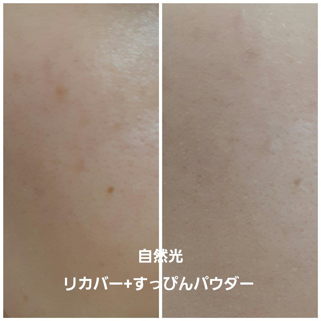 ドクタージャルト シカペア リカバー (第2世代）/Dr.Jart＋/フェイスクリームを使ったクチコミ（2枚目）