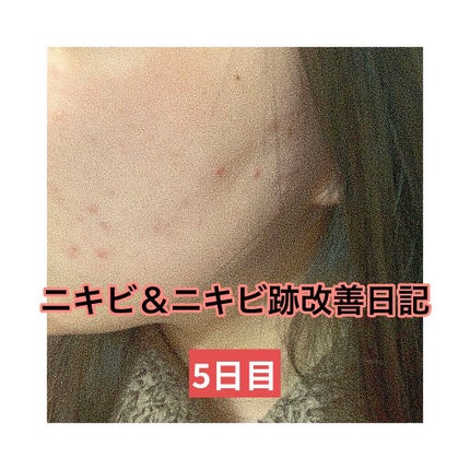 を使ったクチコミ(1枚目)