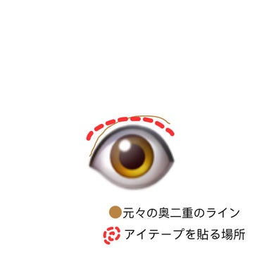 アイテープ片面(のびる)絆創膏タイプ スリム 120枚/セリア/二重まぶた用アイテムを使ったクチコミ（5枚目）