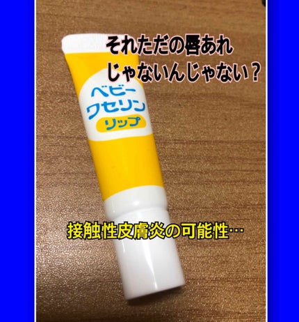 ベビーワセリンリップ/健栄製薬/リップクリームを使ったクチコミ(1枚目)