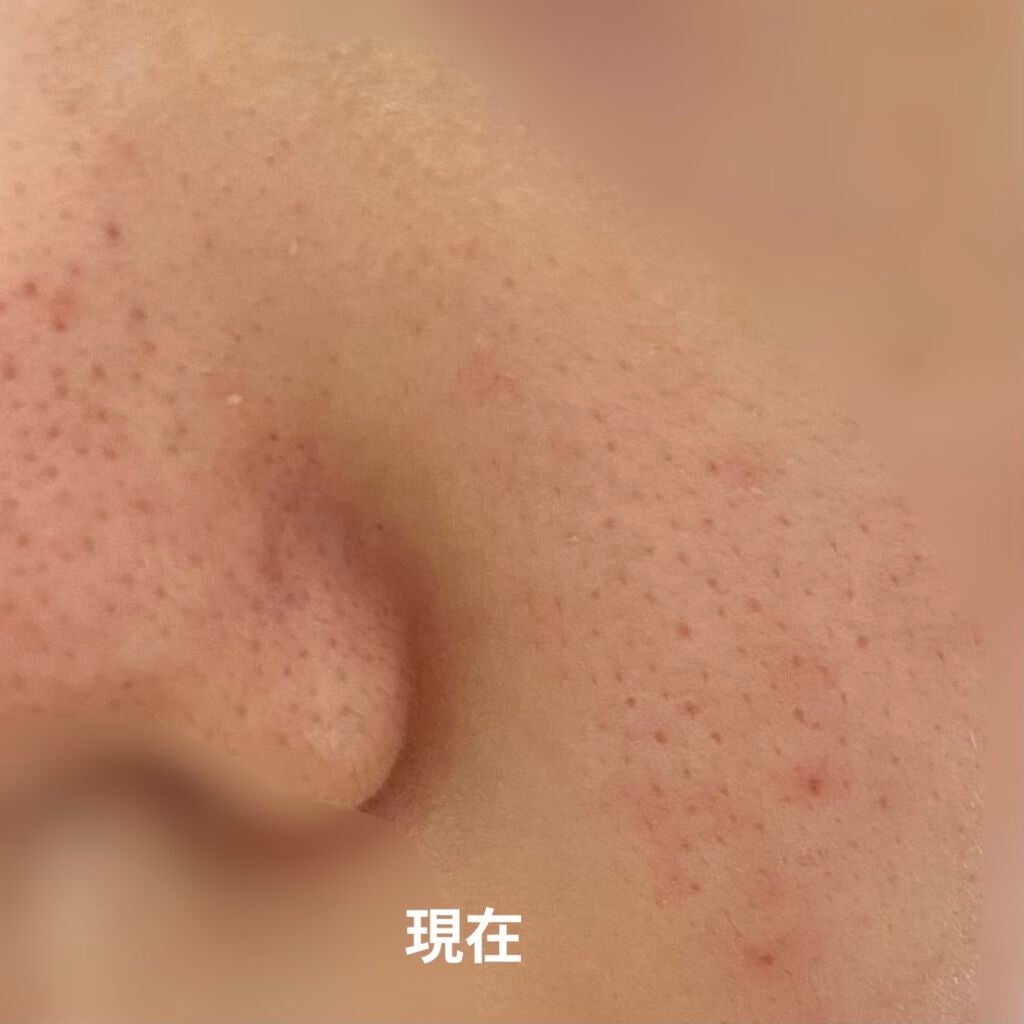 ホホバオイル/無印良品/ボディオイルを使ったクチコミ(4枚目)