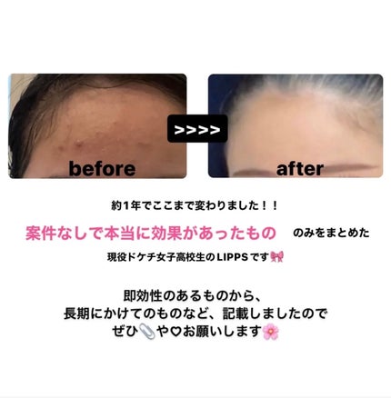 チョコラBBプラス (医薬品)/チョコラBB/その他を使ったクチコミ(2枚目)