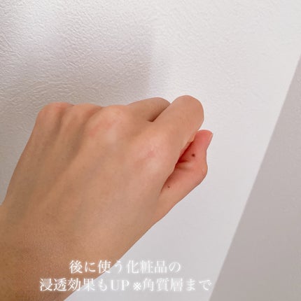 フリーリア 薬用美白フェイスクリアE/コープ/化粧水を使ったクチコミ(4枚目)