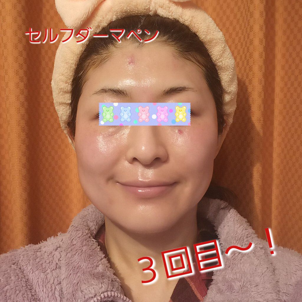 フラーレン10/KISO/美容液を使ったクチコミ（1枚目）