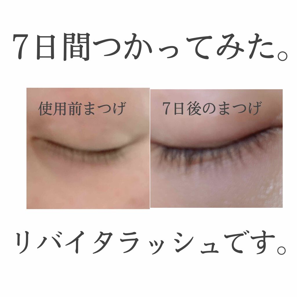 リバイタラッシュ アドバンス ジャパン/エム・アール・アイ/まつげ美容液を使ったクチコミ(1枚目)