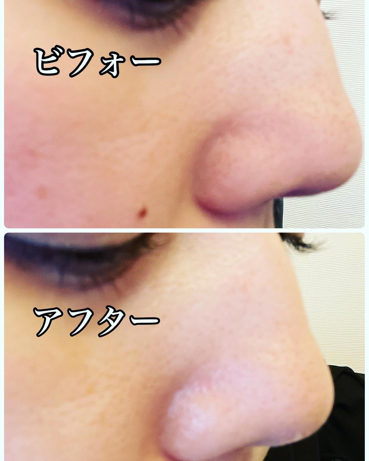 ダヴ 吸着毛穴ケア 洗顔ジェル/ダヴ/その他洗顔料を使ったクチコミ(4枚目)