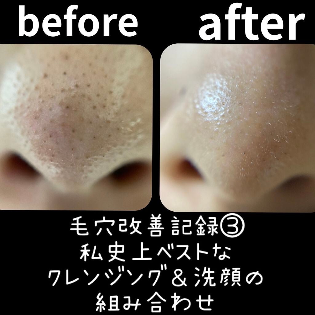 デュオ ザ クレンジングバーム ブラック/DUO/クレンジングバームを使ったクチコミ(1枚目)