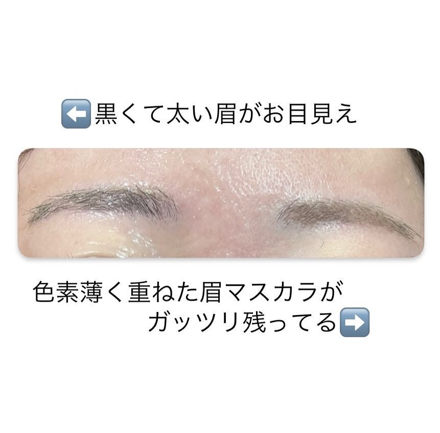 スムースクレンジングバーム VC7/PERFECT ONE FOCUS/クレンジングバームを使ったクチコミ(4枚目)