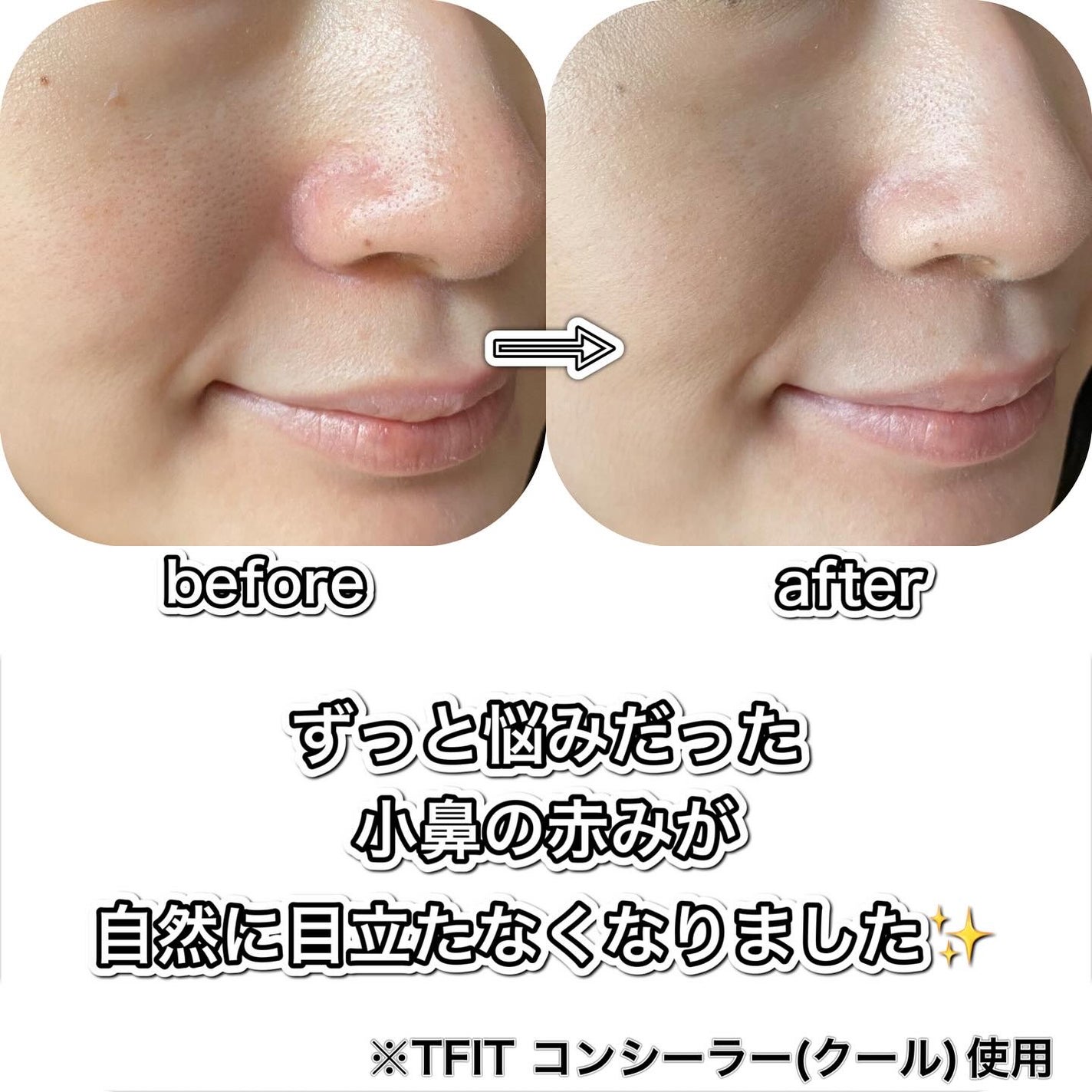 カバーアッププロコンシーラー/TFIT/パレットコンシーラーを使ったクチコミ(3枚目)