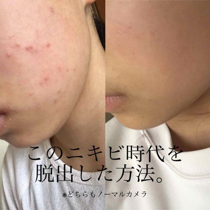 ビタミンクリーム/メンソレータム/ボディクリームを使ったクチコミ(1枚目)