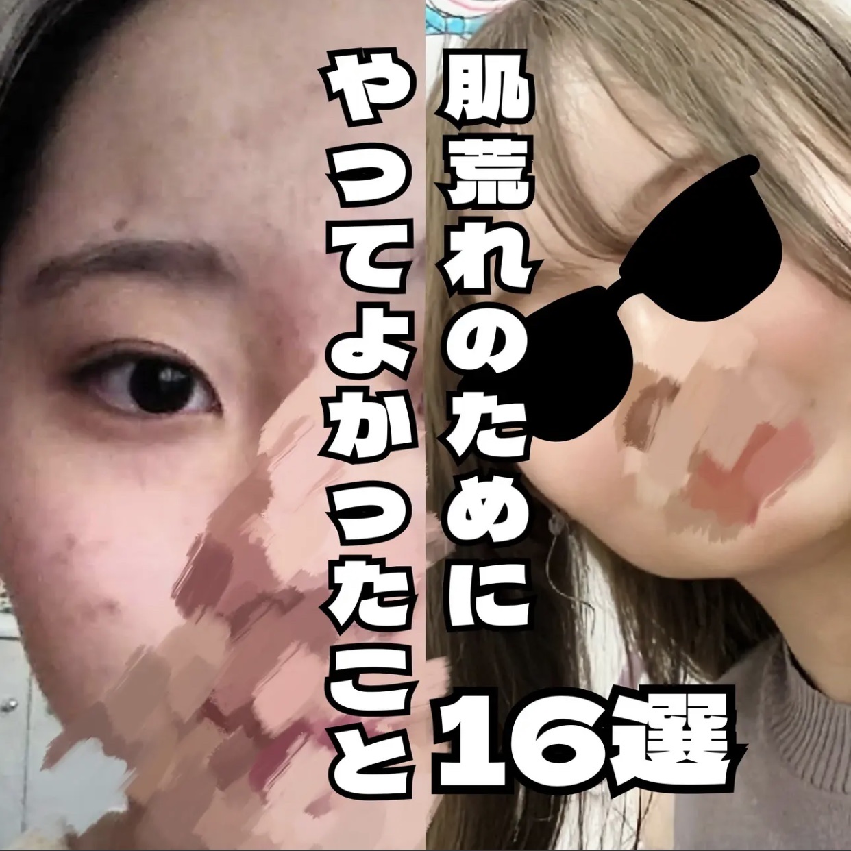 今回は肌荒れに悩む人向けの投稿です！
2枚目の画像の投稿である洗顔料まとめも一緒に見ることをオススメします✨

#スキンケア #ニキビケア #大人ニキビ #ビニール肌 #肌の赤み #おすすめスキンケア #垢抜け #自分磨き #洗顔フォーム 