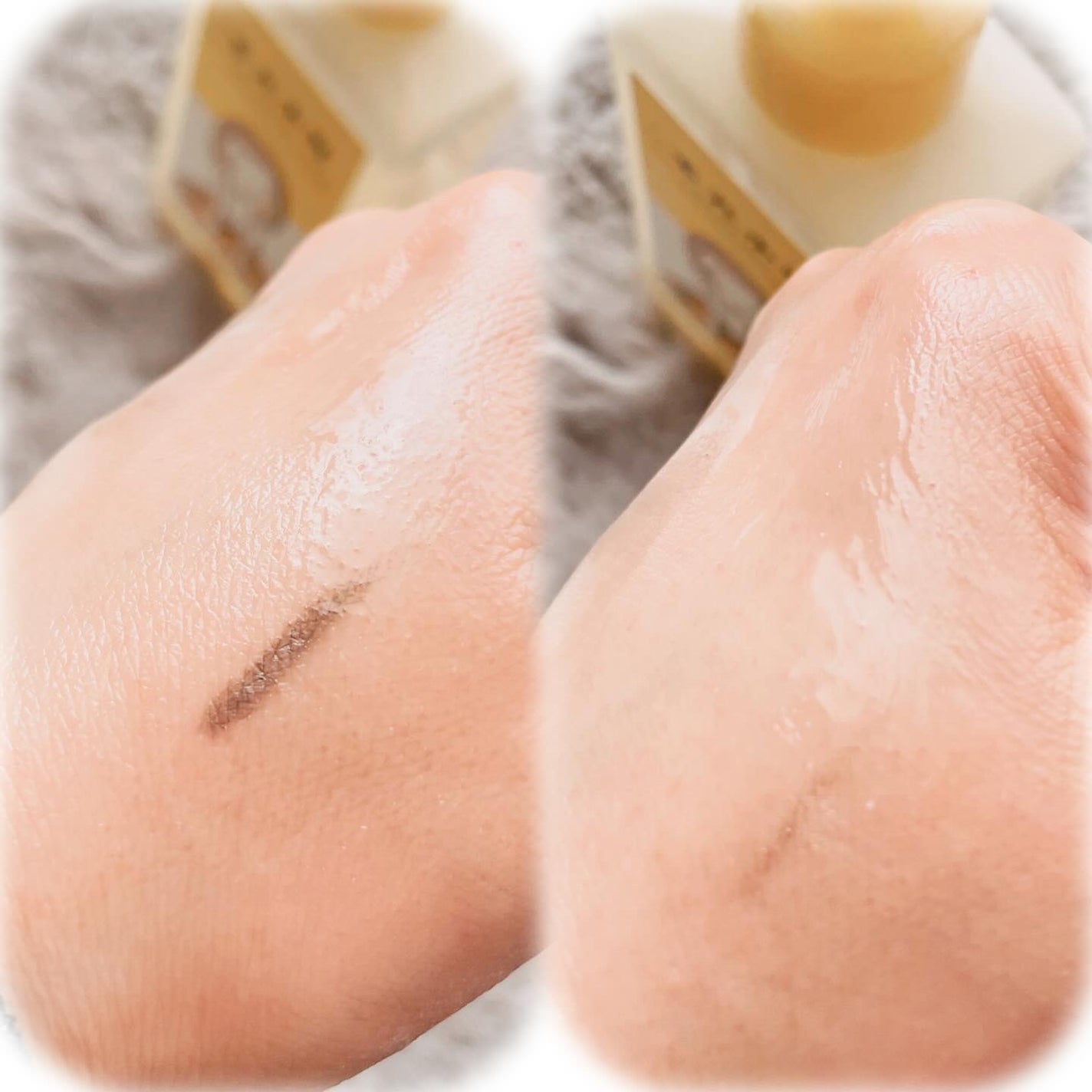 moon on LIPS 「・#PR#ソフティモ#毛穴小町#クレンジングオイル・コーセーコ..」(2枚目)