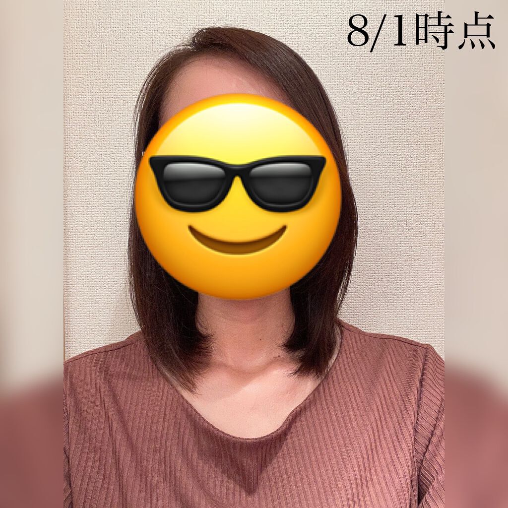 ヘアアクセルレーターEX フローラルアップルの香り/加美乃素本舗/頭皮ローションを使ったクチコミ（2枚目）