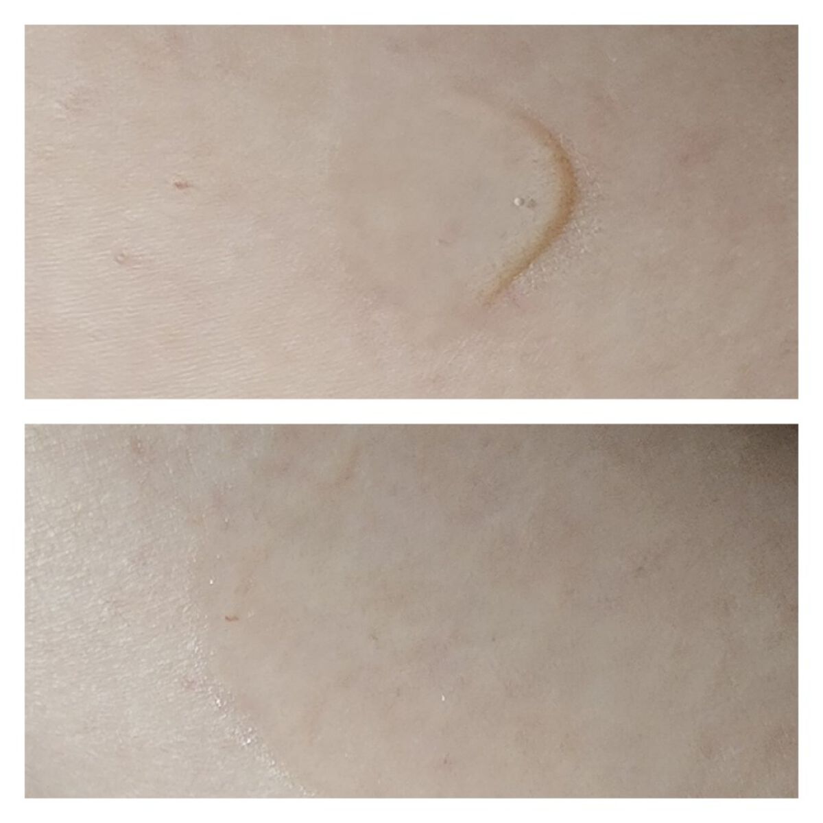 C10 グロウ セラム/THE BODY SHOP/美容液を使ったクチコミ（3枚目）