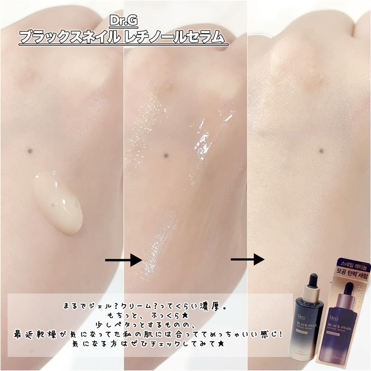 ブラックスネイルレチノールセラム/Dr.G/美容液を使ったクチコミ(3枚目)