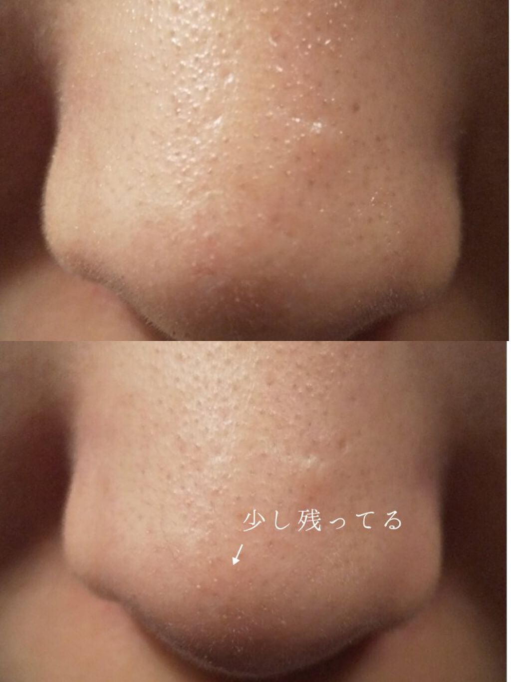 クレンジングバーム クリア/CLAYGE/クレンジングバームを使ったクチコミ(5枚目)