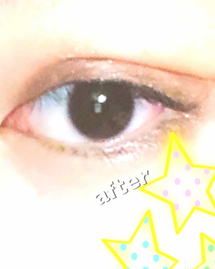 アイテープ(絆創膏タイプ、レギュラー、70枚)/DAISO/二重まぶた用アイテムを使ったクチコミ(3枚目)