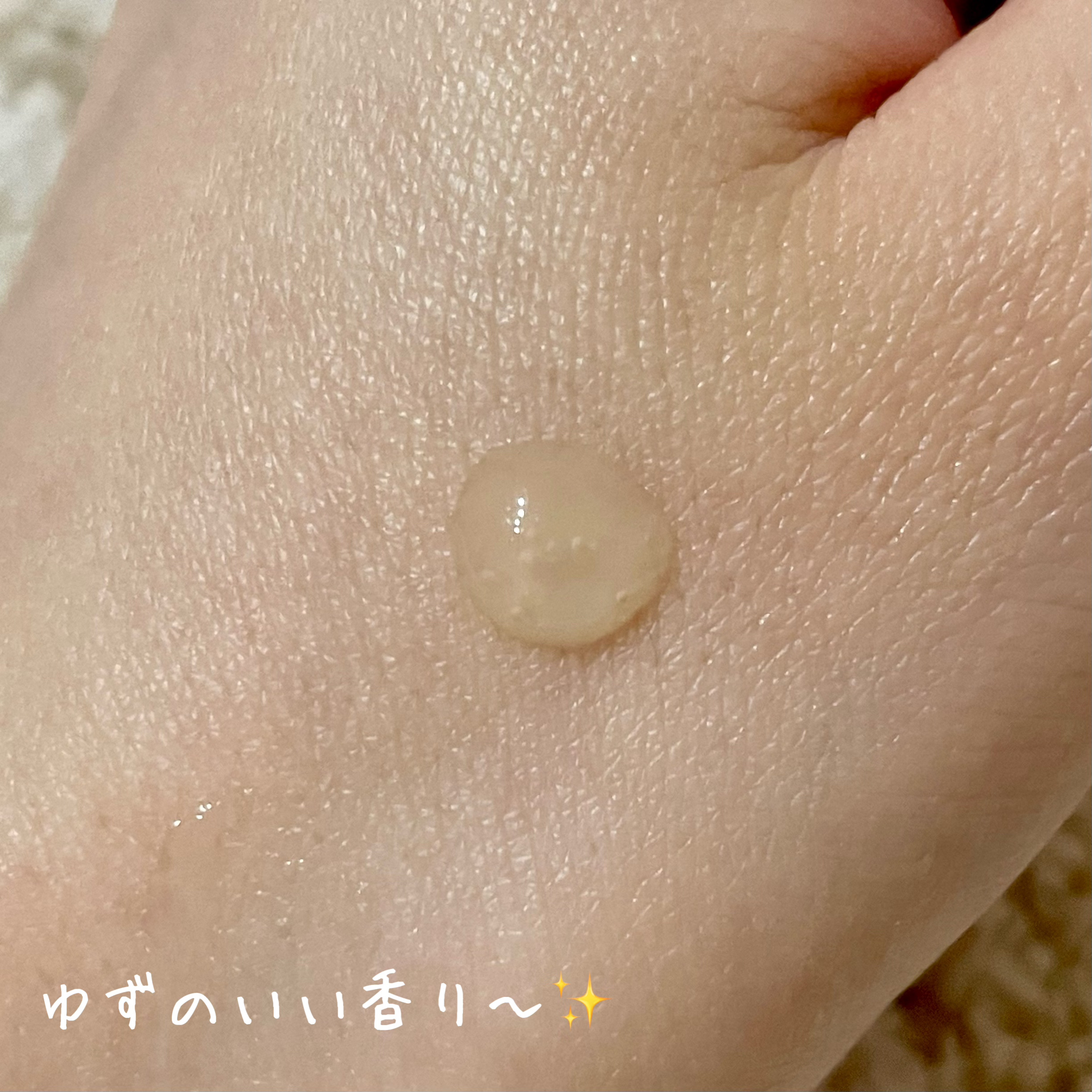 ユズナイアシンアンチブレミッシュセラム ユズナイアシンアンチブレミッシュセラム/SOME BY MI/美容液を使ったクチコミ（2枚目）