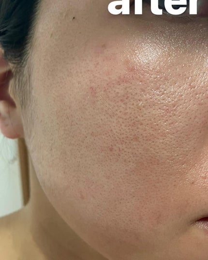 ちーひろ on LIPS 「InstagramでVTレッツリードルショット第2弾キャンペー..」(5枚目)