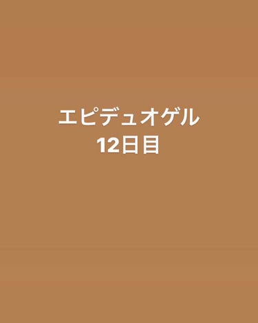 エピデュオゲル/マルホ株式会社/その他を使ったクチコミ（1枚目）