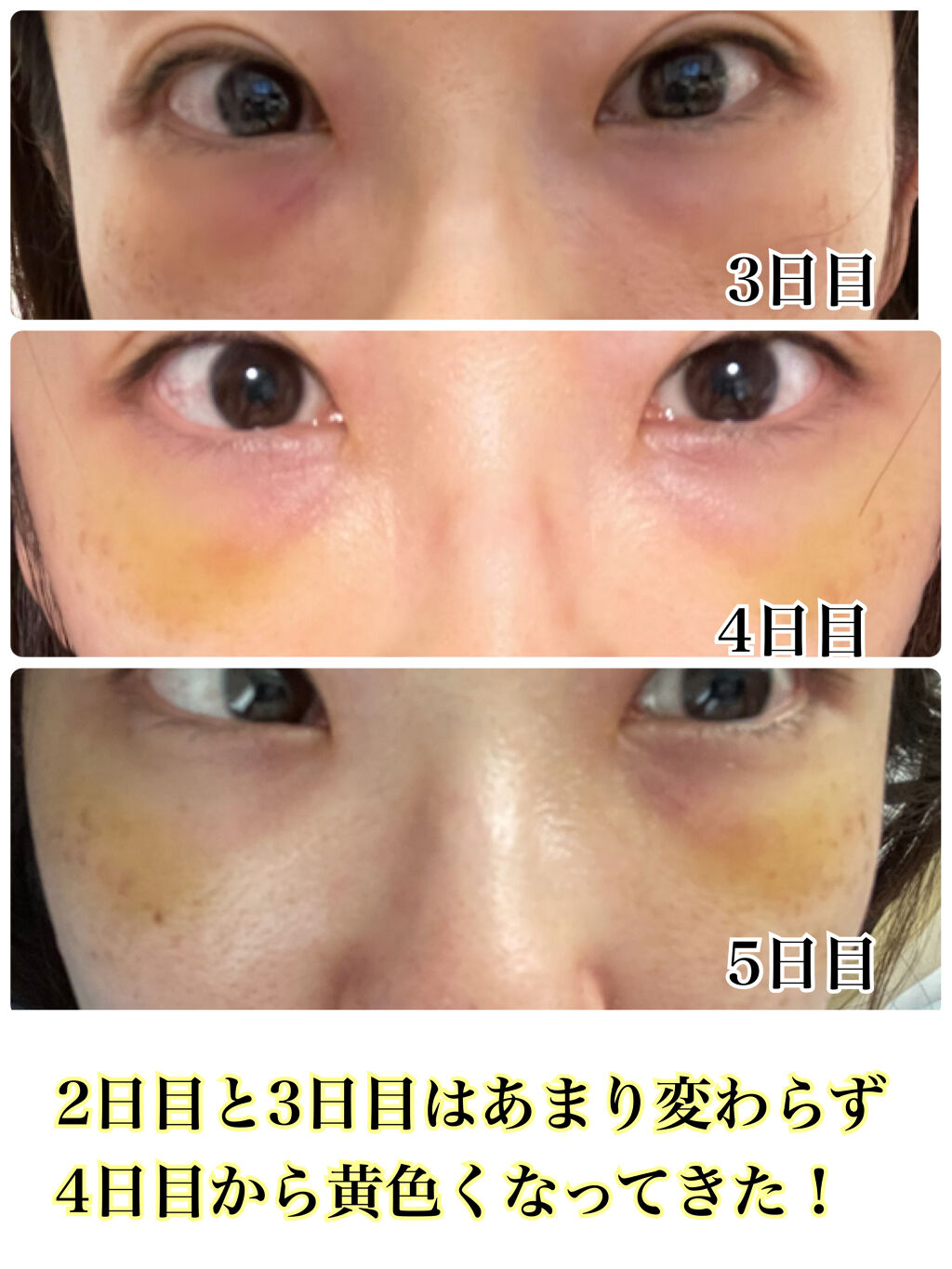 ディエム クルール カラーブレンドパウダーコンシーラー/ディエム クルール/パウダーコンシーラーを使ったクチコミ（3枚目）