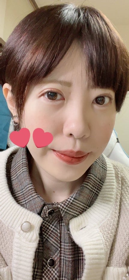 むちぷるティント/キャンメイク/リップティントを使ったクチコミ(6枚目)